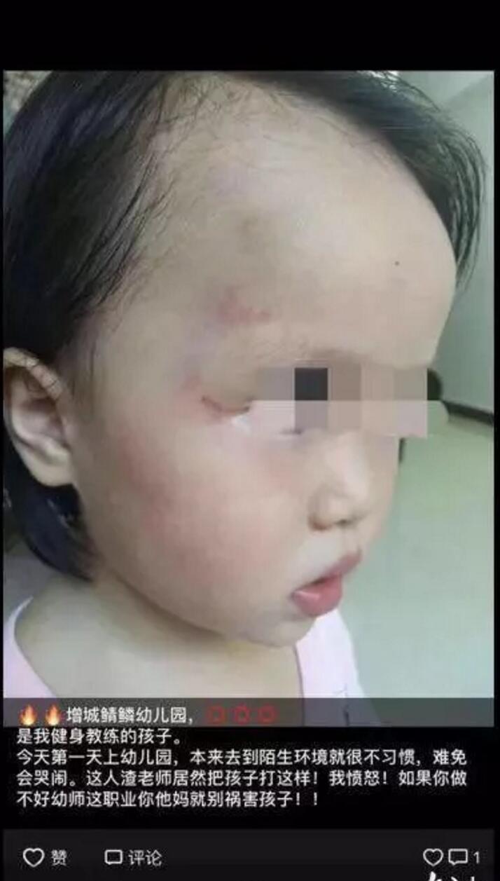 广州又现虐童事件：2岁幼童被幼儿园老师连扇耳光图片 No.4