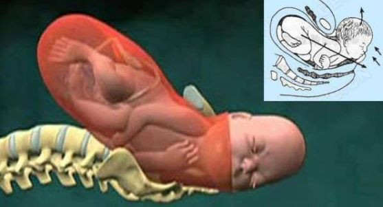 【图示】那么大的胎儿是怎么从妈妈肚子里生出来的，为所有妈妈点赞！图片 No.5